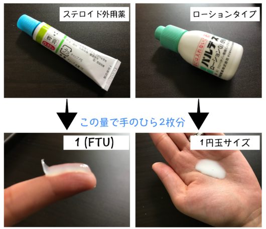 ステロイドの塗る量 ステロイドの塗る量